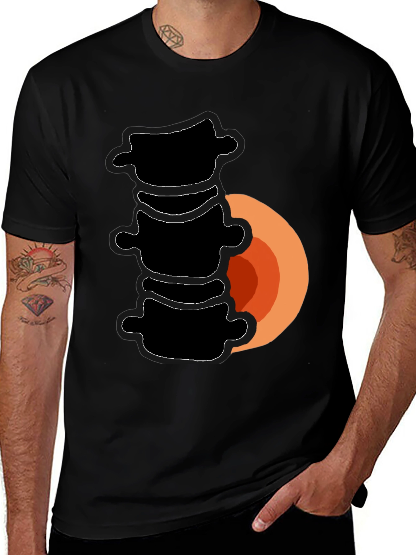Spinal Fusion T-Shirt - Funny Back Surgery Recovery Tee