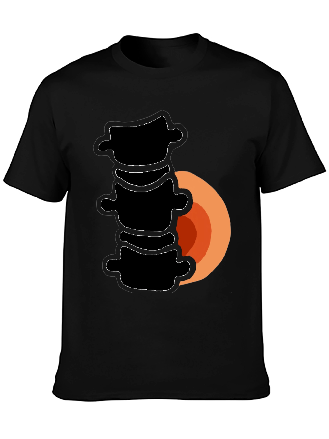 Spinal Fusion T-Shirt - Funny Back Surgery Recovery Tee