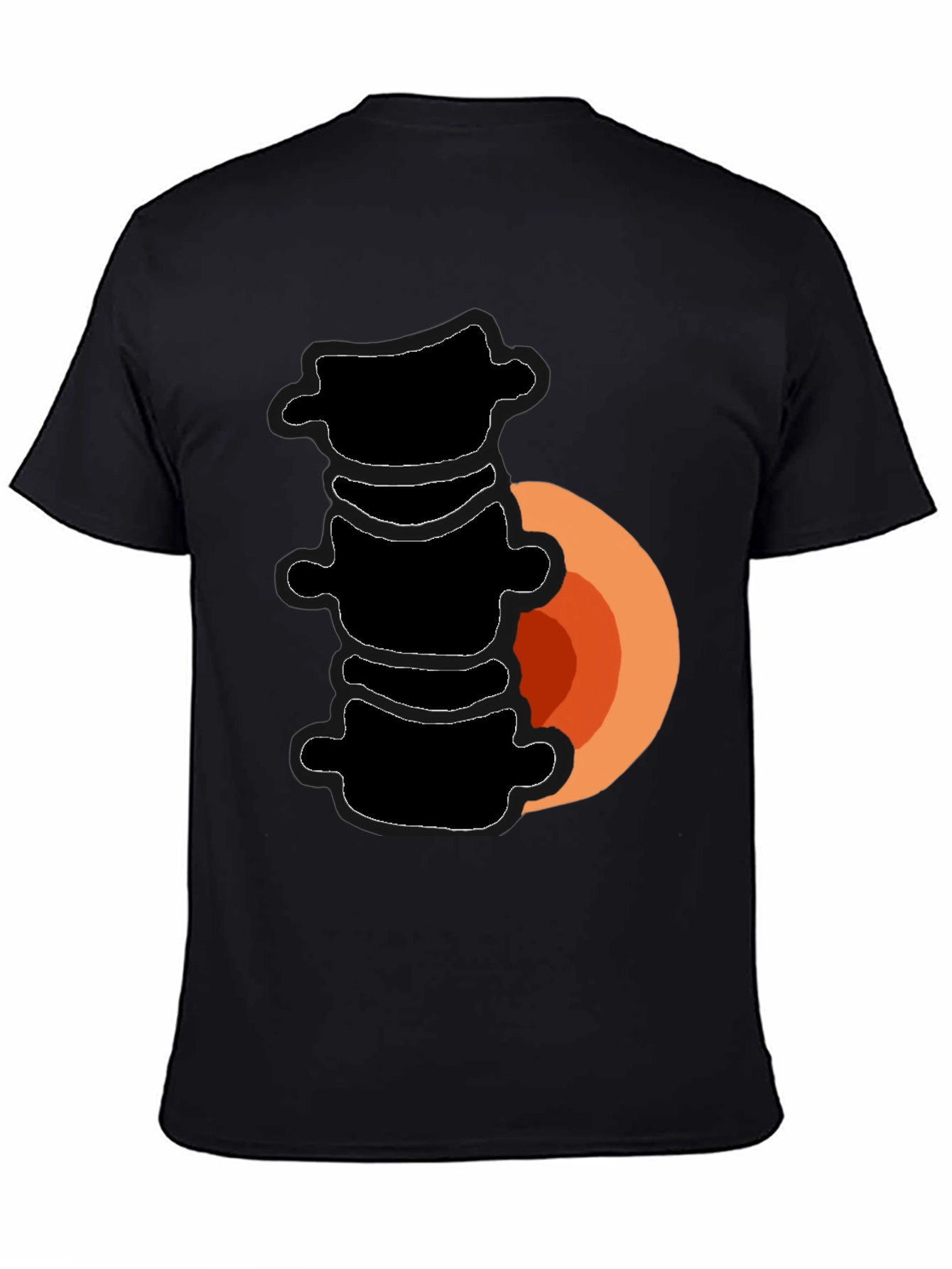 Spinal Fusion T-Shirt - Funny Back Surgery Recovery Tee